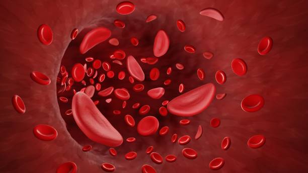 What is Umbilical Cord Blood Stem Cell Transplant?
