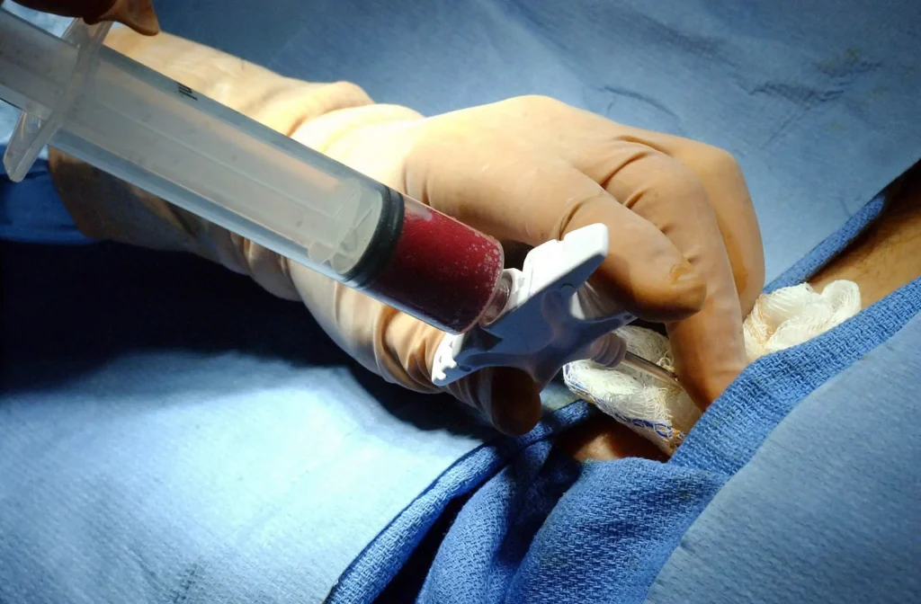 Top Stem Cell Banking for HSCT – What Makes Transcell Unique