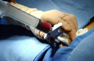 Haematopoietic-stem-cell-transplant-in-children--scaled