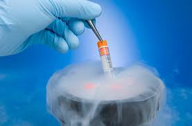 Stem Cell Cryopreservation